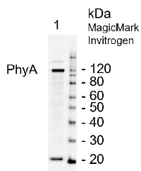 PhyA | Phytochrome A in the group Antibodies Plant/Algal  / Developmental Biology / Photomorphogenesis at Agrisera AB (Antibodies for research) (AS07 220)